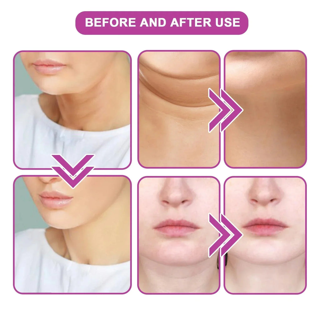 20ML Neck Tightening Cream Neck Massage Cream Reduce Neck Wrinkles Lift And Moisturize Smooth Skin & Provide Neck Care Product