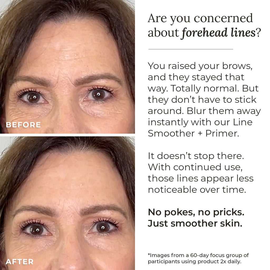 Line Smoother + Primer with Neodermyl®
